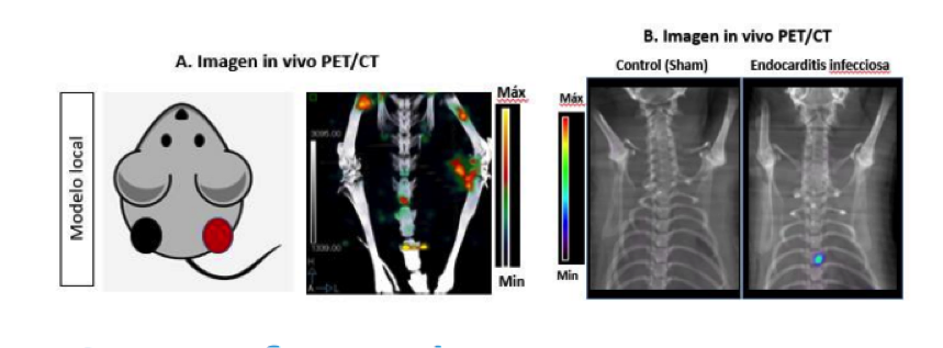 Radioactive compounds for non-invasive detection of Grampositive infectious diseases