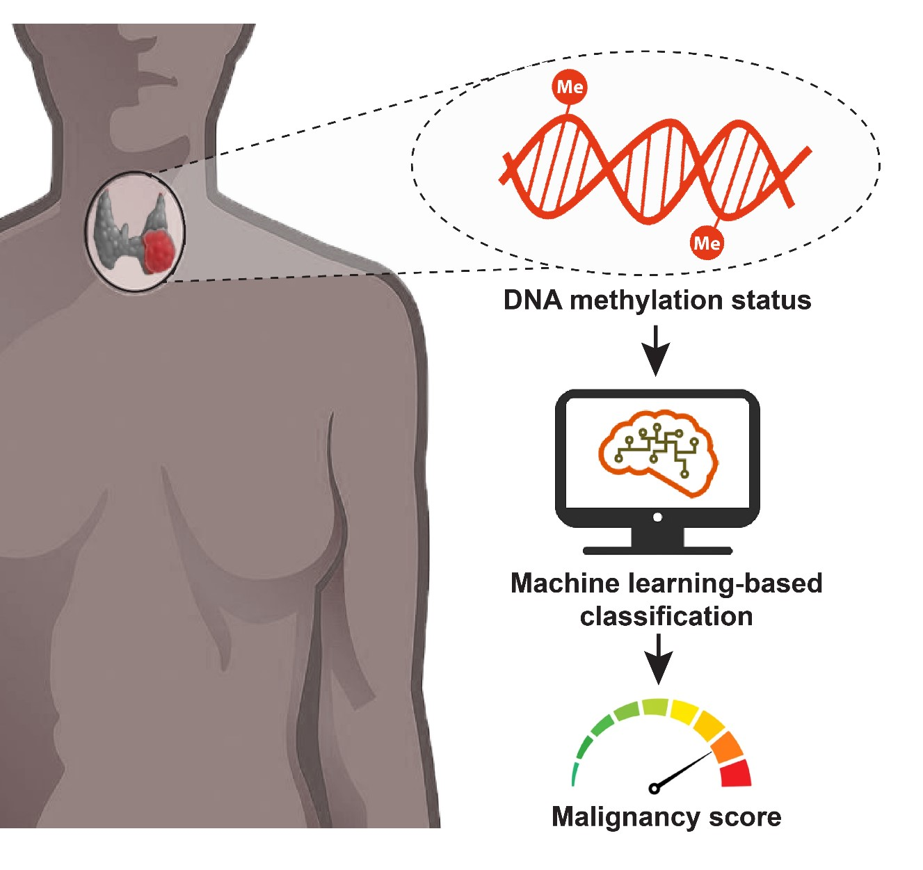 Method for the diagnosis of thyroid cancer based on epigenetic biomarkers